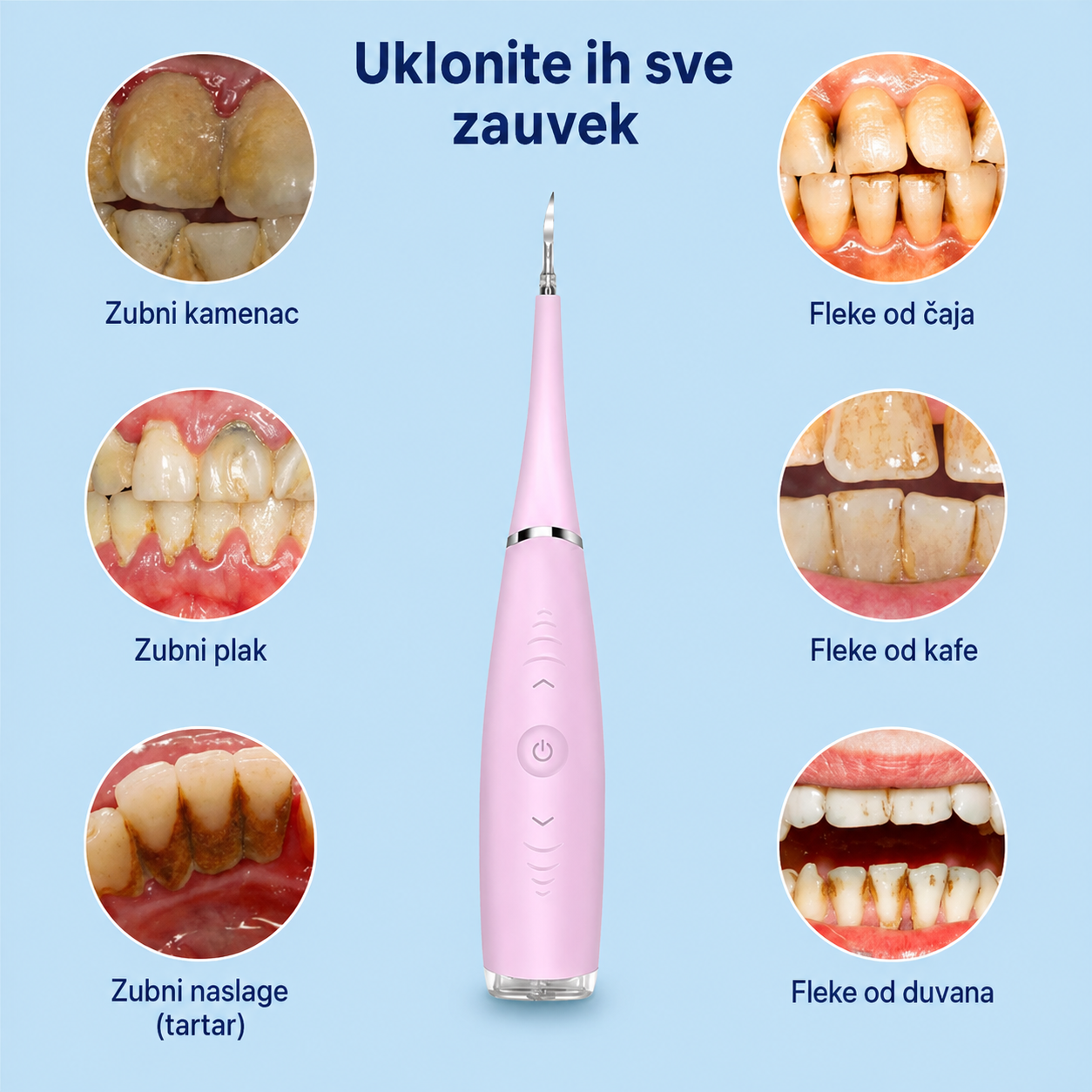 Ultrazvučni Interdentalni čistač za zubni plak i naslage