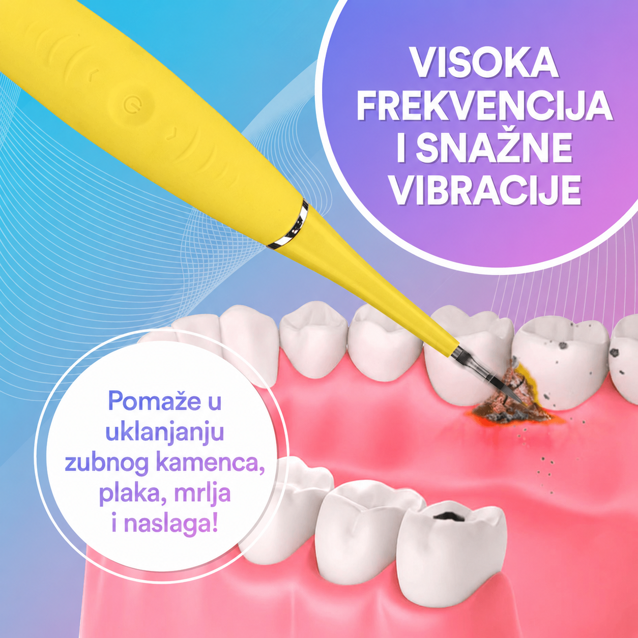 Ultrazvučni Interdentalni čistač za zubni plak i naslage