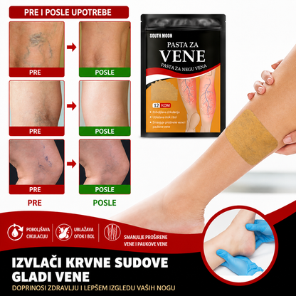 Flasteri za uklanjanje bolova od proširenih vena (pakovanje za mesec dana)