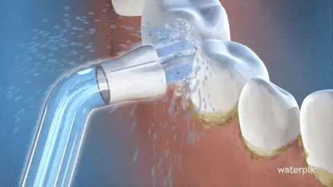 AquaClean Pro – uređaj koji čisti zube tamo gde četkica ne može