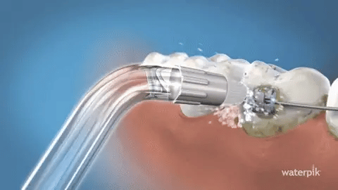 AquaClean Pro – uređaj koji čisti zube tamo gde četkica ne može