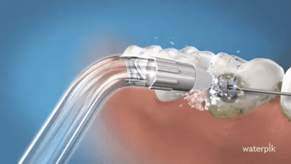AquaClean Pro – uređaj koji čisti zube tamo gde četkica ne može